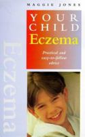 Eczema: Practical and Easy-to-follow Advice (Your Child) 1862042098 Book Cover