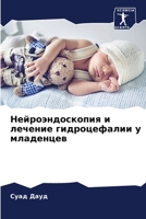Нейроэндоскопия и лечен& 6205704803 Book Cover