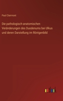 Die pathologisch-anatomischen Veränderungen des Duodenums bei Ulkus und deren Darstellung im Röntgenbild 336844901X Book Cover