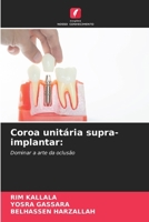 Coroa unitária supra-implantar (Portuguese Edition) 6206675769 Book Cover