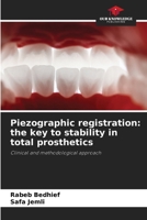 Piezographic registration: the key to stability in total prosthetics 6209499341 Book Cover
