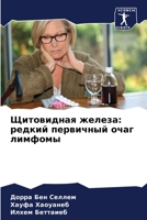 Щитовидная железа: редкий первичный очаг лимфомы 6205817497 Book Cover