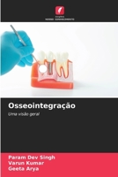 Osseointegração: Uma visão geral (Portuguese Edition) 6204929097 Book Cover
