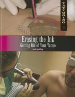 Erasing the Ink: Getting Rid of Your Tattoo 1448846153 Book Cover
