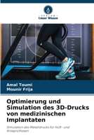 Optimierung und Simulation des 3D-Drucks von medizinischen Implantaten (German Edition) 6208265568 Book Cover