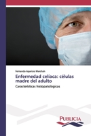 Enfermedad celíaca: células madre del adulto: Características histopatológicas 3639556674 Book Cover