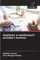 Implanty w zanikowych szczeka i zuchwa (Polish Edition) 6208351324 Book Cover