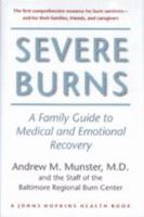 Severe Burns: A Family Guide to Medical and Emotional Recovery (A Johns Hopkins Press Health Book)