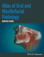 Atlas of Oral and Maxillofacial Radiology 1118939646 Book Cover
