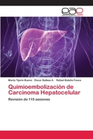 Quimioembolización de Carcinoma Hepatocelular 3659076481 Book Cover