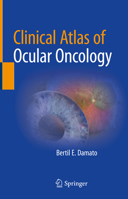Clinical Atlas of Ocular Oncology null Book Cover