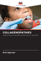 Collagénopathies 6209101550 Book Cover
