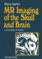 MR Imaging of the Skull and Brain: A Correlative Text-Atlas 354052293X Book Cover