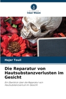 Die Reparatur von Hautsubstanzverlusten im Gesicht (German Edition) 6208095743 Book Cover