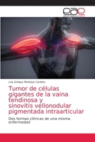 Tumor de células gigantes de la vaina tendinosa y sinovitis vellonodular pigmentada intraarticular 6203871494 Book Cover