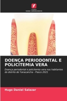 Doença Periodontal E Policitemia Vera 6205556715 Book Cover