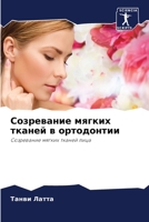 Созревание мягких тканей в ортодонтии: Созревание мягких тканей лица 6206053113 Book Cover