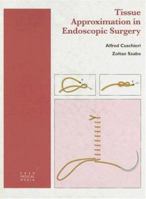 Tissue Approximation in Endoscopic Surgery: Suturing & Knotting (Isis Medical Media) 1899066039 Book Cover