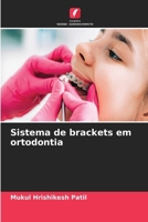 Sistema de brackets em ortodontia (Portuguese Edition) 6206919005 Book Cover