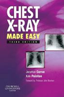 Chest X-Ray Made Easy 0443070083 Book Cover