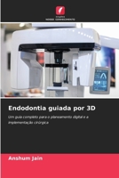 Endodontia guiada por 3D (Portuguese Edition) 6202041471 Book Cover