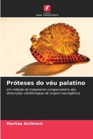 Próteses do véu palatino (Portuguese Edition) 6209807186 Book Cover