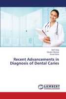 Recent Advancements in Diagnosis of Dental Caries 3659155209 Book Cover