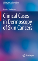 Clinical Cases in Dermoscopy of Skin Cancers 3030294463 Book Cover