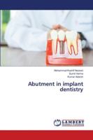 Abutment in implant dentistry 6202673257 Book Cover