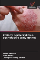 Zmiany pecherzykowo-pecherzowe jamy ustnej (Polish Edition) 6208442133 Book Cover
