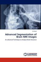 Advanced Segmentation of Brain MRI Images 3847345745 Book Cover