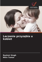 Leczenie przyzebia u kobiet (Polish Edition) 6202323787 Book Cover