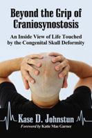 Beyond the Grip of Craniosynostosis: An Inside View of Life Touched by the Congenital Skull Deformity 0786475692 Book Cover