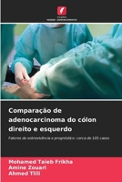 Comparação de adenocarcinoma do cólon direito e esquerdo (Portuguese Edition) 6207750314 Book Cover