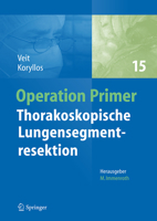 Thorakoskopische Lungensegmentresektion (Operation Primers, 15) (German Edition) 3662687291 Book Cover