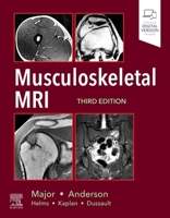 Musculoskeletal MRI 0323415601 Book Cover