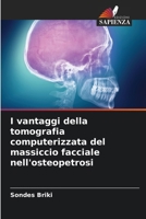 I vantaggi della tomografia computerizzata del massiccio facciale nell'osteopetrosi 6209081924 Book Cover