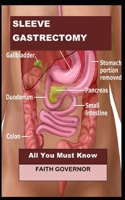 Sleeve Gastrectomy: All You Must Know B098GTZVF8 Book Cover