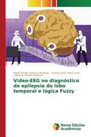 Video-Eeg No Diagnostico de Epilepsia Do Lobo Temporal E Logica Fuzzy 3841714773 Book Cover