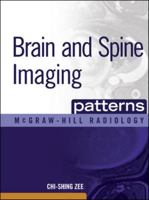 Patterns: Brain & Spine Imaging (Patterns) 0071465413 Book Cover