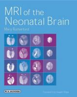MRI of the Neonatal Brain 0702025348 Book Cover