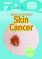 Frequently Asked Questions About Skin Cancer 144888327X Book Cover