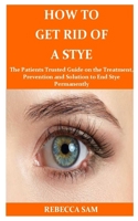 How to Get Rid of a Stye: The Patients Trusted Guide on the Treatment, Prevention and Solution to End Stye Permanently 1712993496 Book Cover