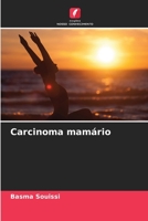 Carcinoma mamário 6206087794 Book Cover