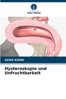 Hysteroskopie und Unfruchtbarkeit (German Edition) 6630497236 Book Cover