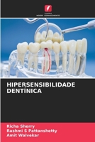 Hipersensibilidade Dentínica (Portuguese Edition) 6630359925 Book Cover