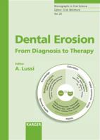Dental Erosion 3805580975 Book Cover