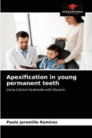 Apexification in young permanent teeth: Using Calcium Hydroxide with Glycerin 6203638137 Book Cover