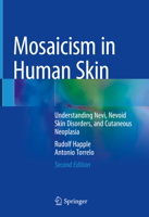 Mosaicism in Human Skin: Understanding Nevi, Nevoid Skin Disorders, and Cutaneous Neoplasia 3030899365 Book Cover
