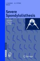 Severe Spondylolisthesis: Pathology - Diagnosis - Therapy 3798512531 Book Cover